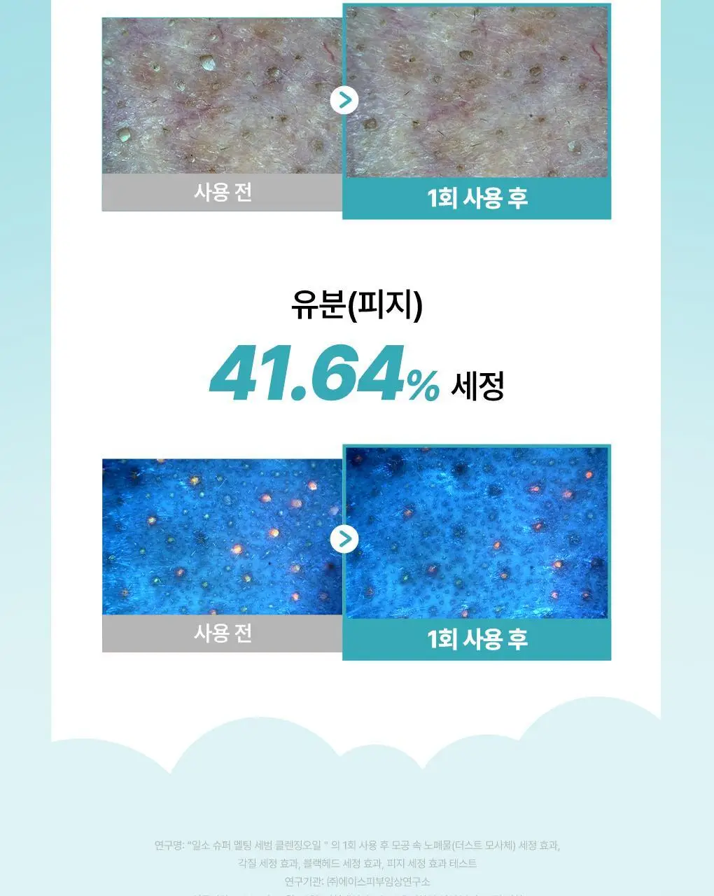 [망곰 콜라보] 일소 슈퍼 멜팅 세범 클렌징오일 200ml 기획 (+스크런치) 상세페이지 22
